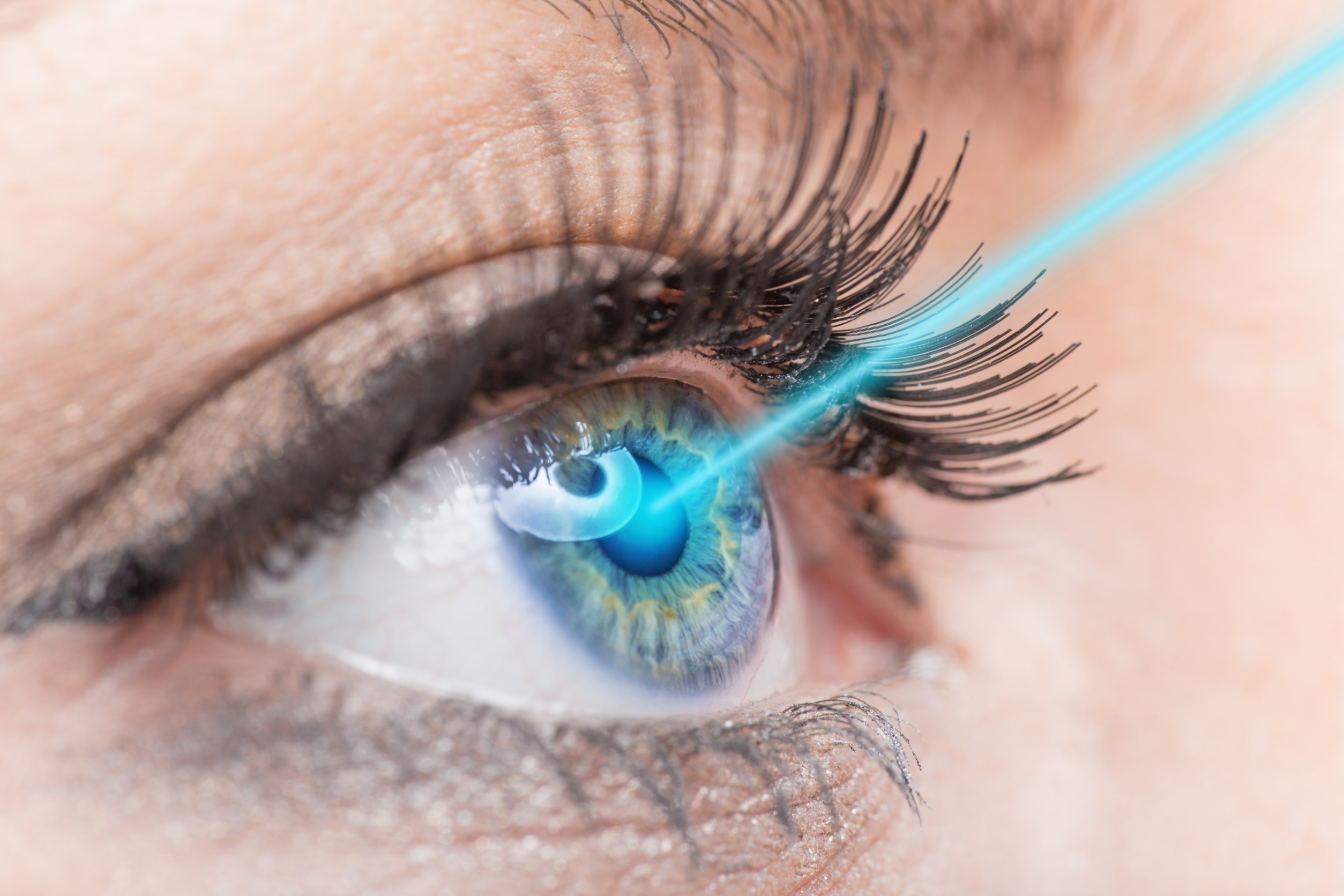 白內障理賠試算情境